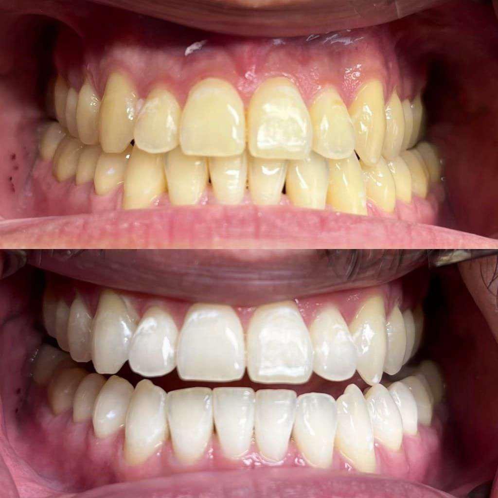 Before and After 3